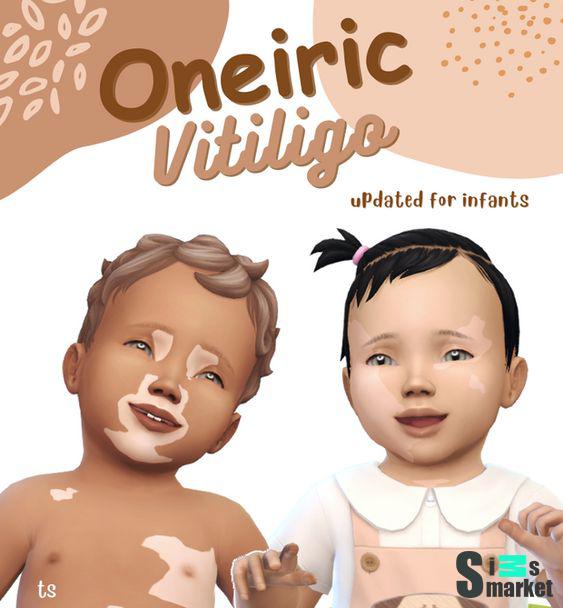 витилиго 'Oneiric vitiligo' для Симс 4. Скачать мод