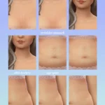 Body-kit No.2