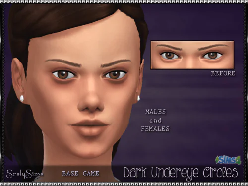 Dark Undereye Circles