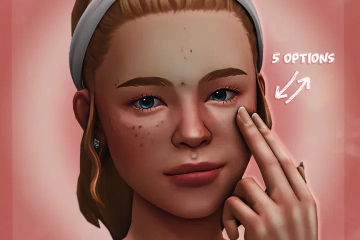 Акне и воспаления на лице