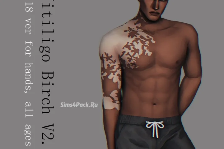 Витилиго для рук "Vitiligo "Birch" Version 2.1"