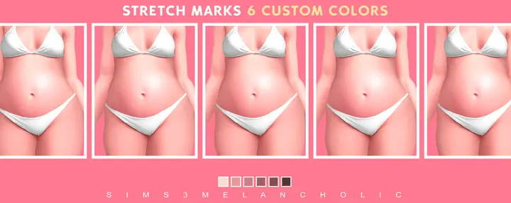 Stretch Marks