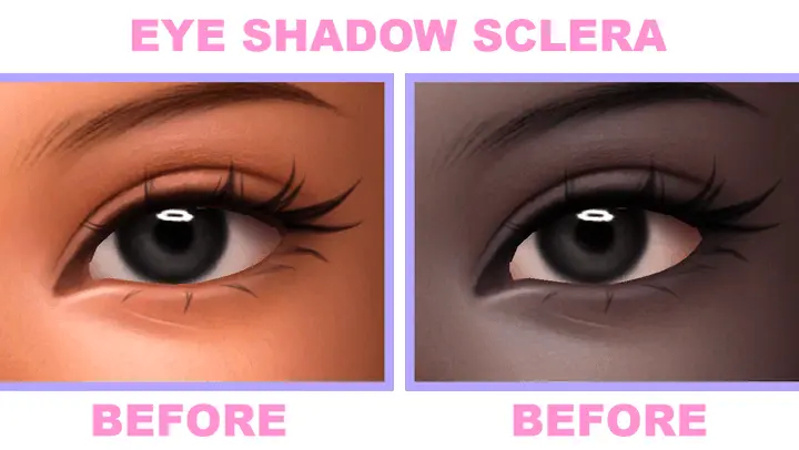 Sclera #10