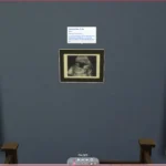 Ultrasound Scan
