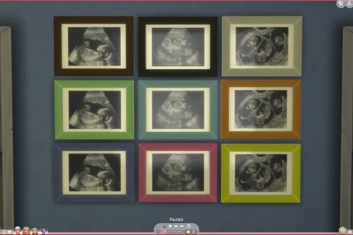 Ultrasound Scan